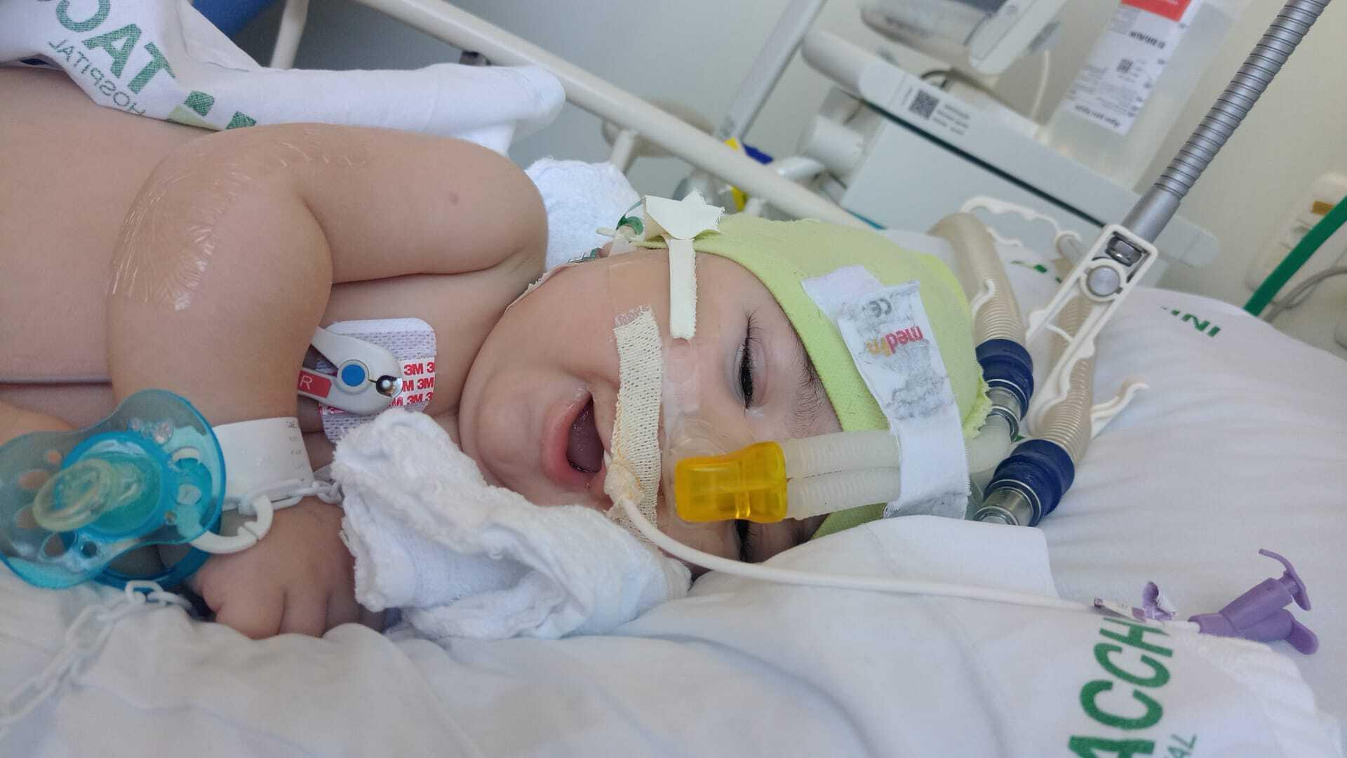 Mãe faz campanha de arrecadação para tratamento de bebê com Atrofia Muscular Espinhal em Farroupilha